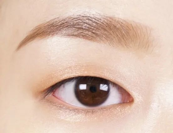 没有内眦赘皮的话,石锤了,双眼皮!下一个!