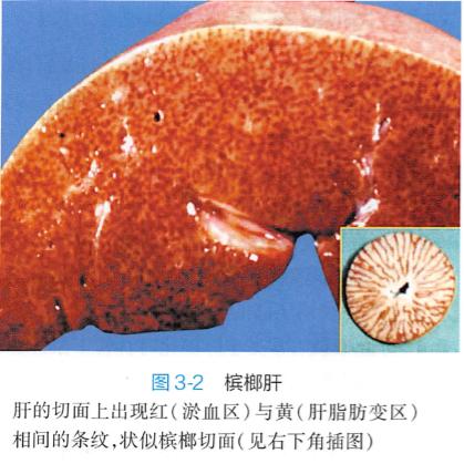 槟榔肝图片