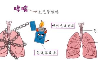 漫画 | 爱玩“捆绑诱惑”的支气管哮喘