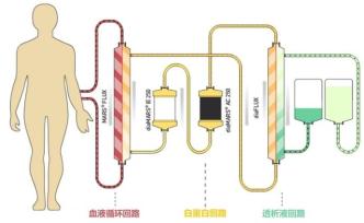 疫情中的救命神器“人工肝”，是怎样炼成的？