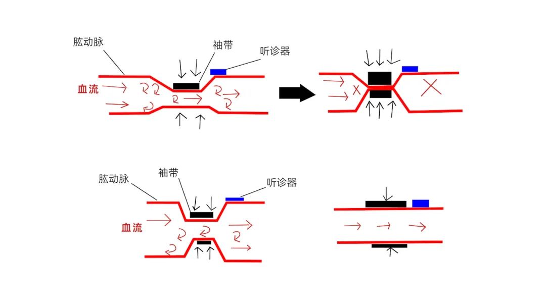 水银血压计原理图图片