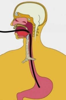 气管与胃管的结构图图片