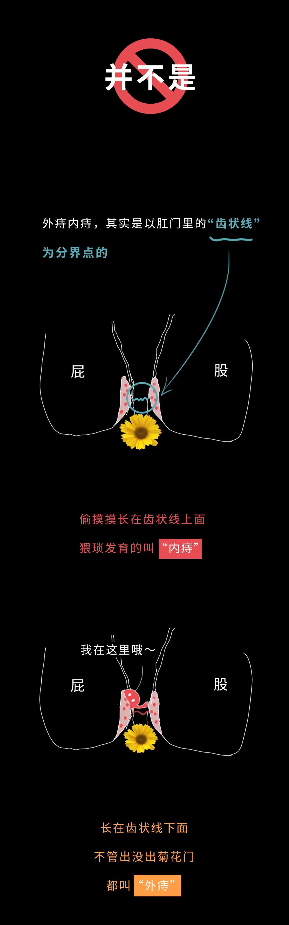 附錄1:提肛運動是指有規律地往上提收肛門,然後放鬆,一提一鬆就是提肛