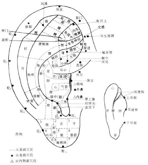 康复馆常见疾病的防治之耳穴埋豆疼痛性疾病