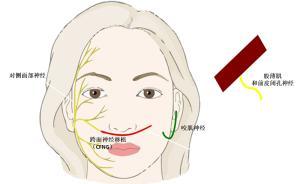 問答｜面癱臉如何才能不“尬笑”？