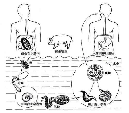 生吃了这种食物28岁小伙肺脑子长满寄生虫