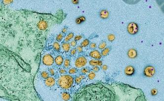 《自然》：科学家发现全新免疫机制，普通细胞也能诱捕并中和超级细菌释放的杀伤性毒素