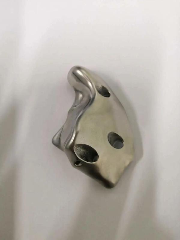 给小刘做了个踝关节的假体,把碎了的关节置换出来!