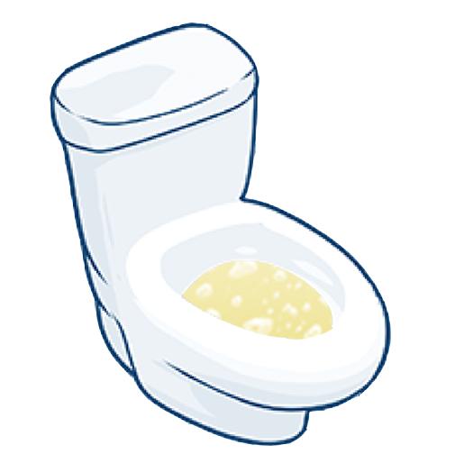 泡沫尿肉眼血尿专家提醒:长时间剧烈运动,高强度健身后可能出现血尿