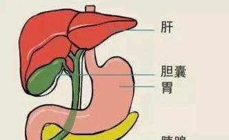 胆囊结石要不要做手术？不做增加肝癌发病率，做了增加肠癌发病率