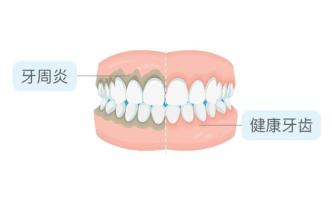 亲吻可能传播的4种疾病，很多人还不知道