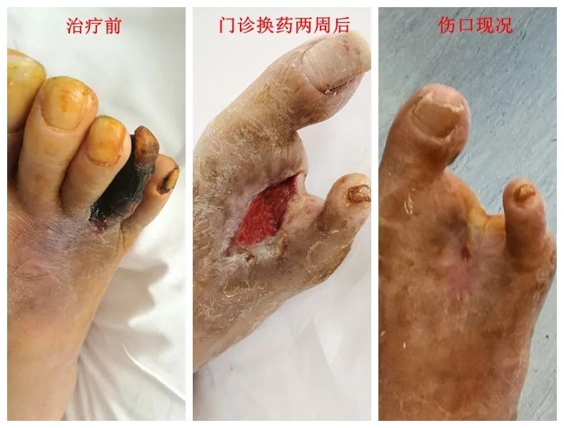 康康医生讲故事我的脚趾叫顺六