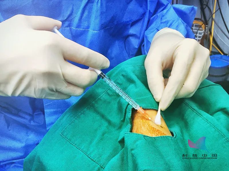 尴尬!做手术时,为什么要脱光衣服和裤子?真正的目的其实是