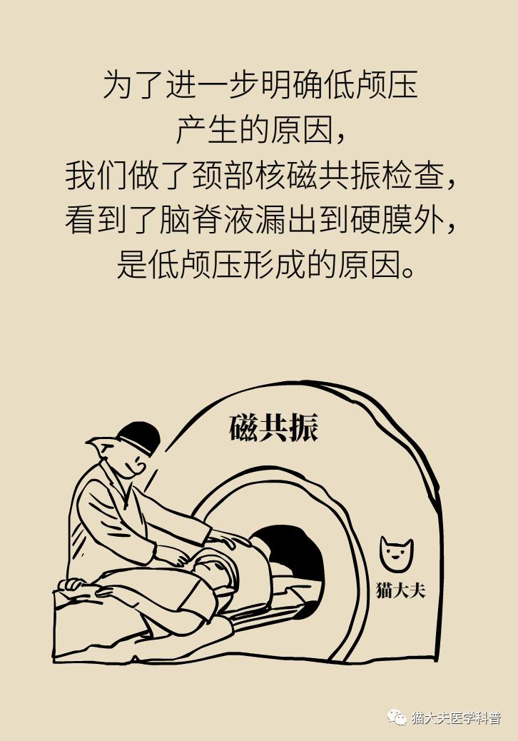 嚇人練瑜伽竟把腦脊液拉漏了丨低顱壓頭痛