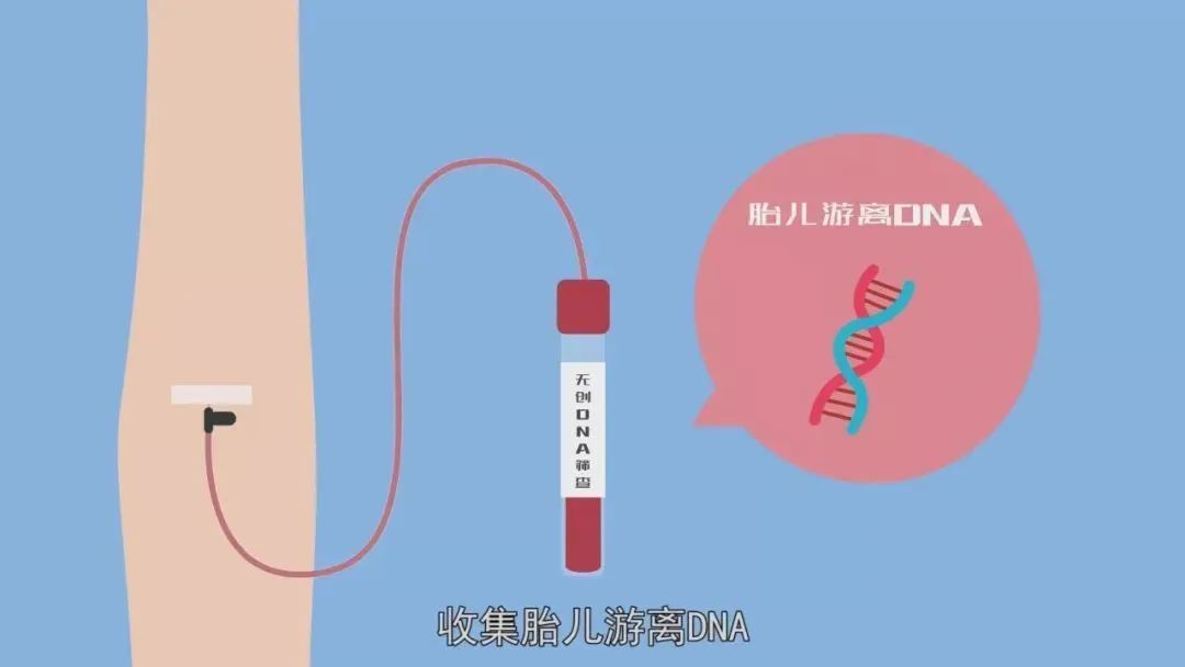 孕妈妈必备课无创dna知多少