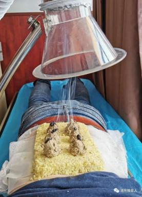 中医艾养生督灸助阳气