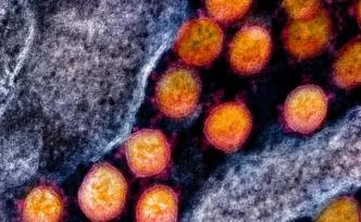 新发现：发生D614G突变的新冠病毒，更易感染人类细胞