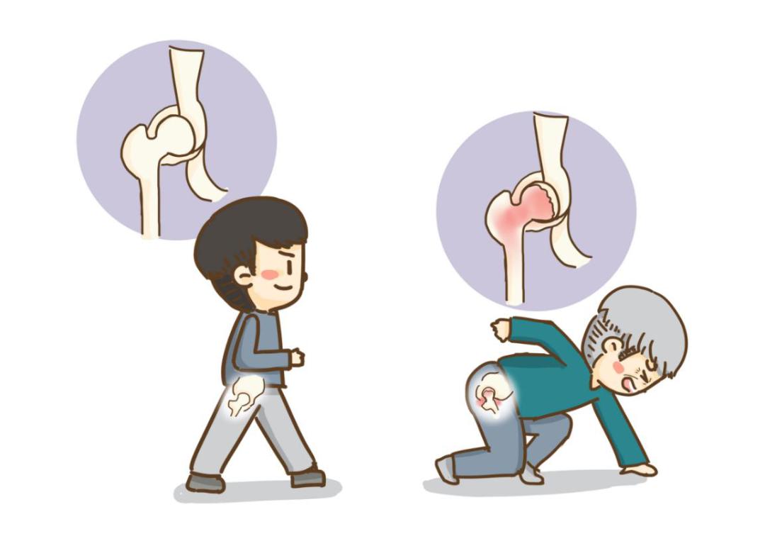 【科普】高龄老人大腿骨折,隔天却"健步如飞",缘由在它!