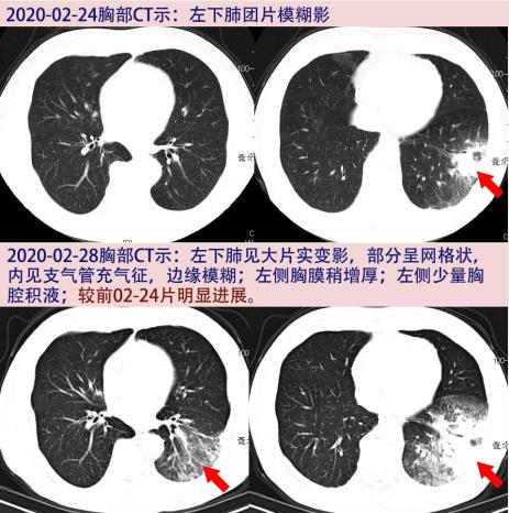 搬迁 公司价格洗空调竟然洗出肺炎,这个锅谁背?