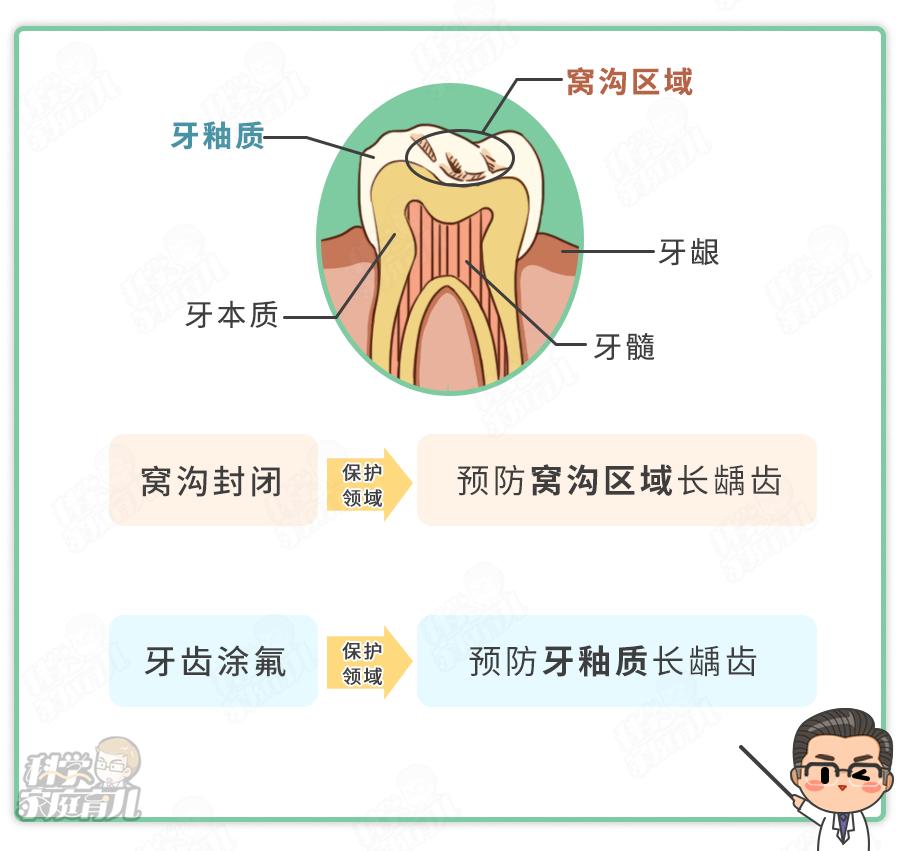 窝沟封闭和牙齿涂氟虽说都能防龋齿,但保护的区域是完全不一样的75