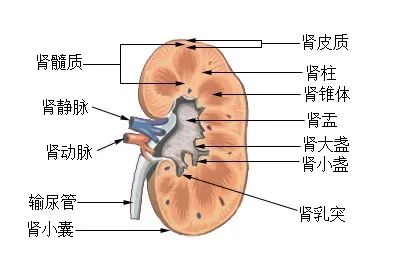 如何预防肾结石?