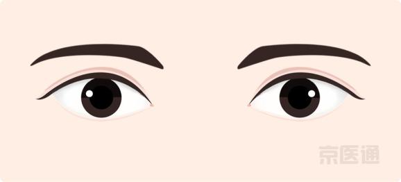 同仁眼科专家 看着很吓人的3种病 其实不用治 湃客 澎湃新闻 The Paper