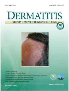 75有些脱毛膏使用者甚至出现毛发在皮肤表皮下生长,导致内嵌毛刺入