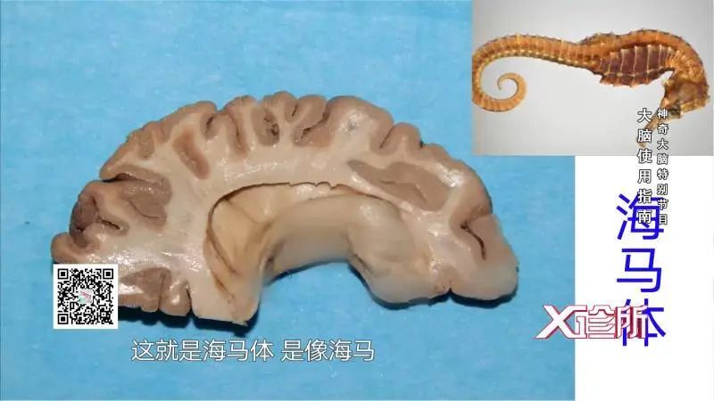 海马体——记忆功能大脑各个区域掌管着不同的功能,其中有记忆功能很