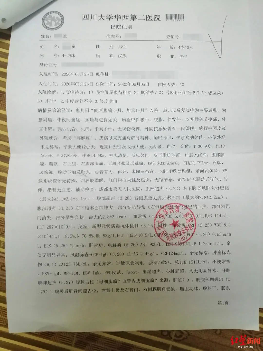 入院 憩室 炎