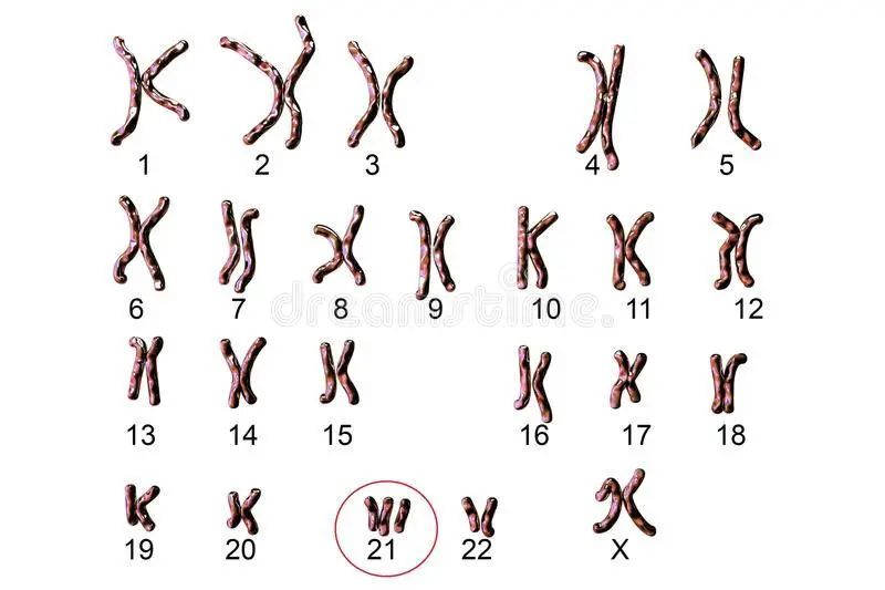 染色体组型正常图片
