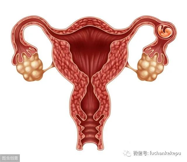 什么是黄体囊 535.jpg