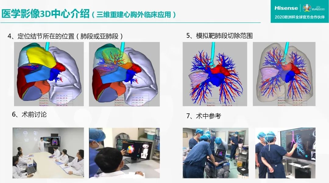 数字医学青大附院三维影像云平台正式上线