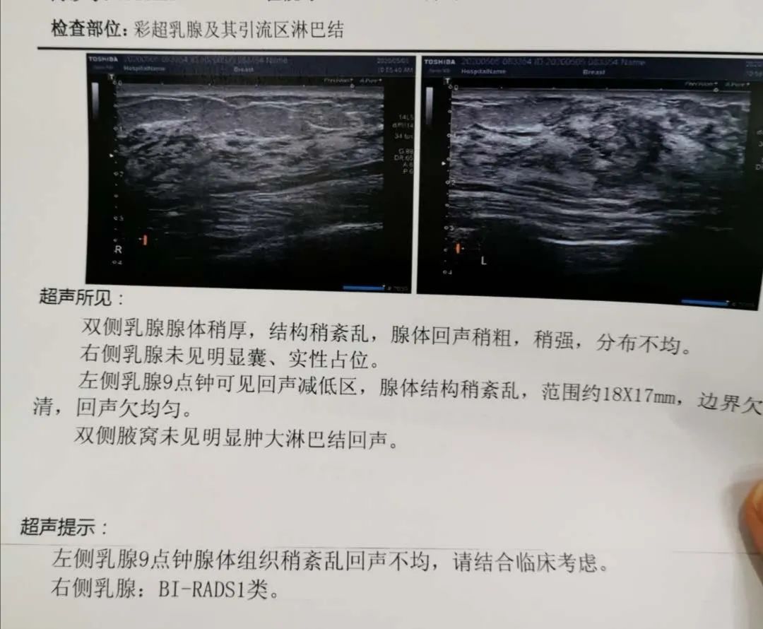 按 压 揉 捏 挤 还伸手进去翻 我经历了震慑灵魂的痛 湃客 澎湃新闻 The Paper