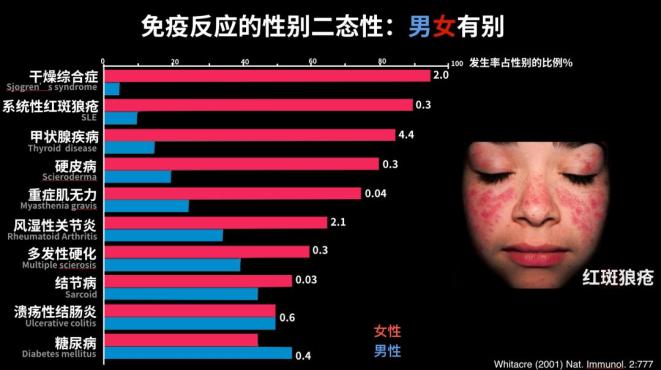 这个小姑娘脸上的蝴蝶斑是红斑狼疮中最轻的一种症状表现,实际上红斑