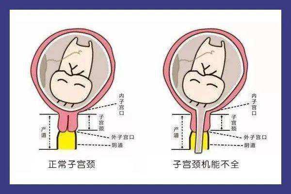 3年流产3胎 这次她终于成功顺产 湃客 澎湃新闻 The Paper