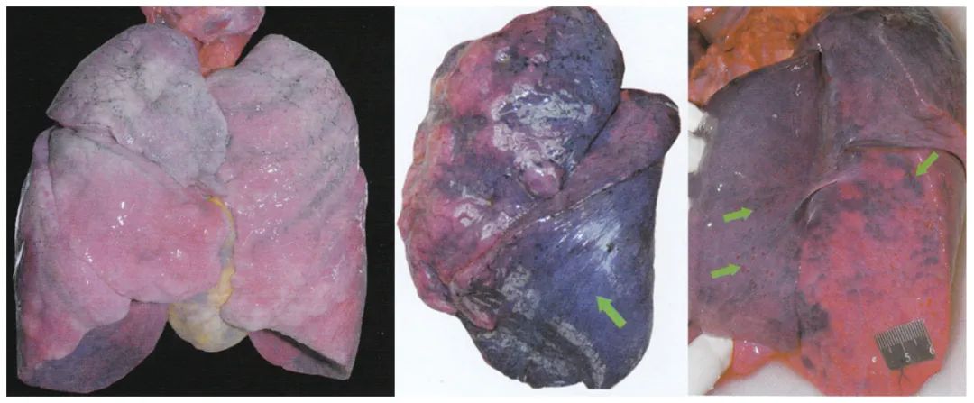 不开刀的尸检真有可能吗