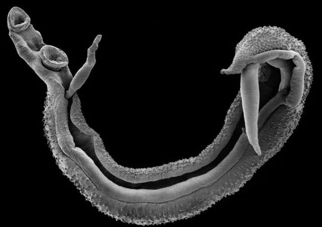其中,日本血吸虫分布在亚洲的中国,日本,菲律宾和印度尼西亚,这种