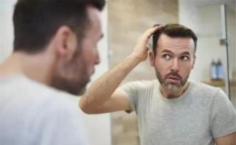 男性脱发是肾虚？