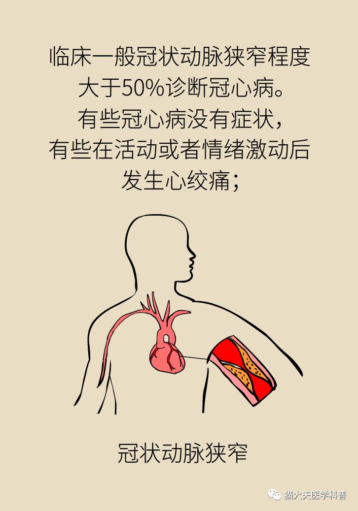 心肌梗死心绞痛都跟它有关慢性冠状动脉疾病是什么