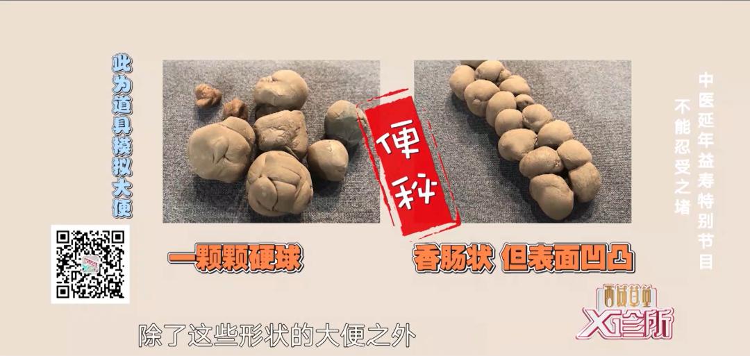 便秘能否根治便血是肠癌的征兆