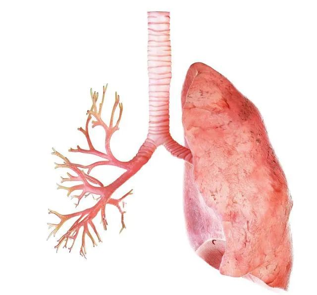 千万不要患上这种遗传性罕见病 囊性肺纤维化发生于儿童 多夭折