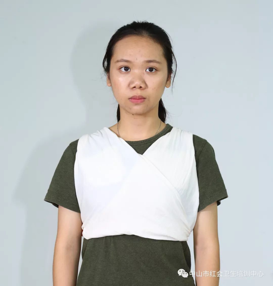 用干净纱布或布料覆盖伤口处,用手压着止血,再用绷带或三角巾加压包扎