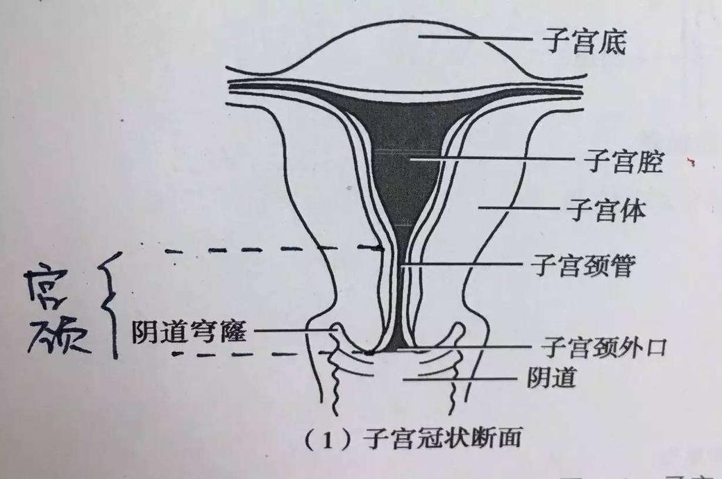 女婴生殖区图图片