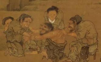 唐代人玩艾灸，看得肉疼