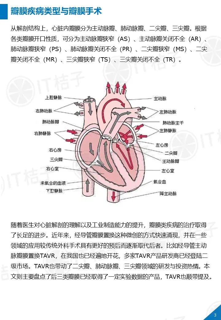 医疗器械投资正热,我们研究了国内外最值得关注的心脏瓣膜置换产品