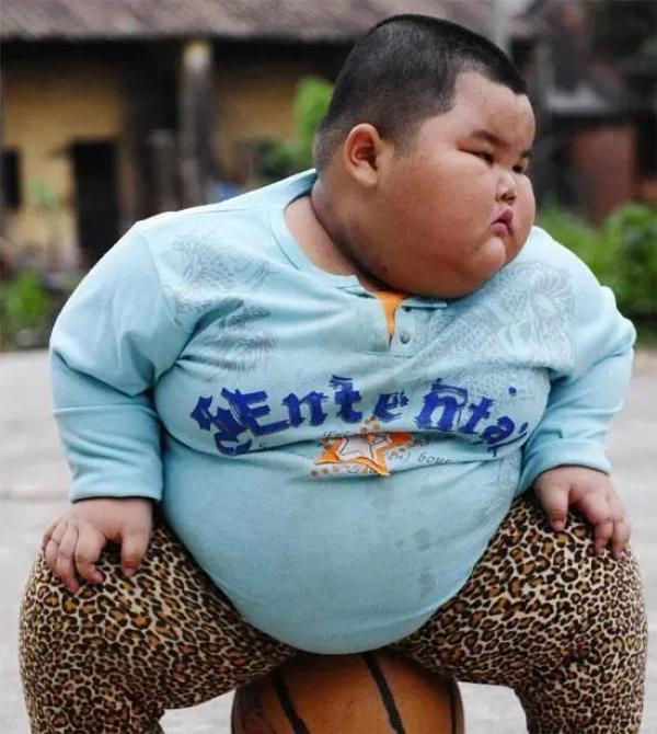 3岁小胖墩120斤小小年纪就患有三高关注儿童健康刻不容缓