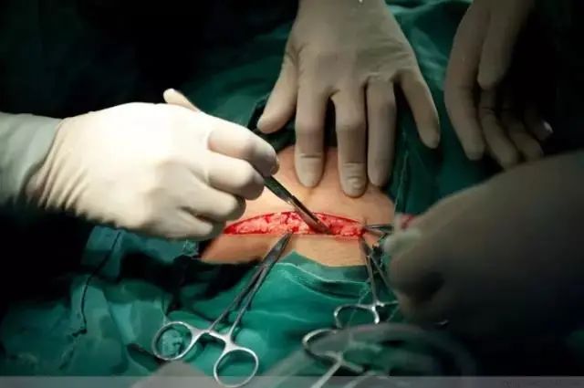 的非常可怕,其实产妇这会儿什么感觉也没有;刀口肯定会流血,所以手术