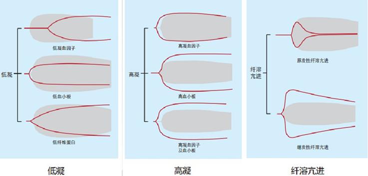 血栓弹力图,弹的是什么?