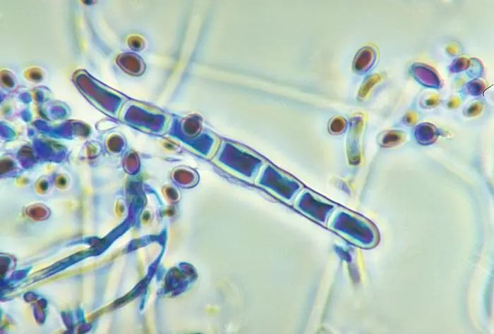 显微镜下的真菌脚气图片