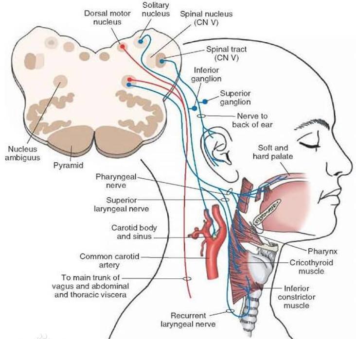 所以主要受影響的核團為疑核—迷走——舌咽神經核,而副神經不受影響